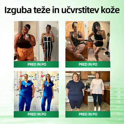Uradna trgovina | 👨‍⚕️ CureVivo® Moringa · Berberin × NAD+ 10-v-1 napredni nano mikroneedle obliž 🇸🇮 (Enkrat na dan, vidni rezultati v 7 dneh) ✅ Za prekomerno telesno težo, ohlapno kožo, sladkorno bolezen, spalno apnejo, težave s sklepi in več🐃🐃