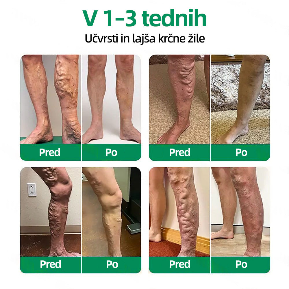 🇸🇮👨‍⚕️👍✅ Healrize® VeinTarget mikroigelni obliž ⚡ Takojšnje olajšanje, dolgotrajni rezultati 🍟🍟