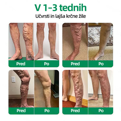 🇸🇮👨‍⚕️👍✅ Healrize® VeinTarget mikroigelni obliž ⚡ Takojšnje olajšanje, dolgotrajni rezultati 🍟🍟