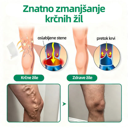 🇸🇮👨‍⚕️👍✅ Healrize® VeinTarget mikroigelni obliž ⚡ Takojšnje olajšanje, dolgotrajni rezultati 🍟🍟