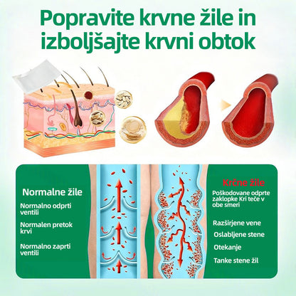 🇸🇮👨‍⚕️👍✅ Healrize® VeinTarget mikroigelni obliž ⚡ Takojšnje olajšanje, dolgotrajni rezultati 🍟🍟