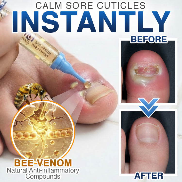 🇦🇺 CareBreeze® Fungi Free Bee Venom Nail Treatment 🐝