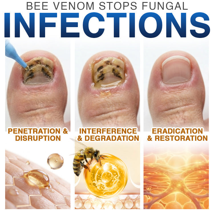 🇦🇺 CareBreeze® Fungi Free Bee Venom Nail Treatment 🐝